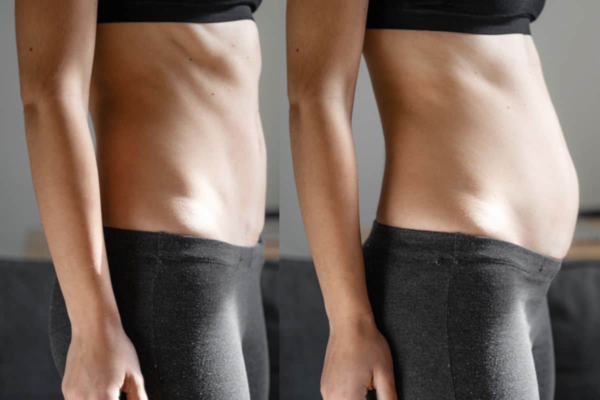 How long does diastasis recti take to improve Edmonton?
