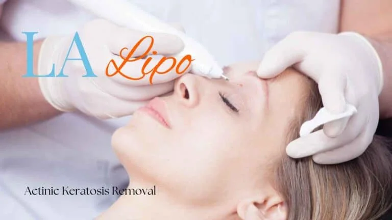 Woman receiving Actinic Keratosis Removal Treatment Edmonton