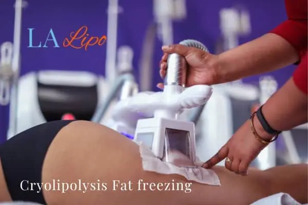 women getting fat freezing Edmonton