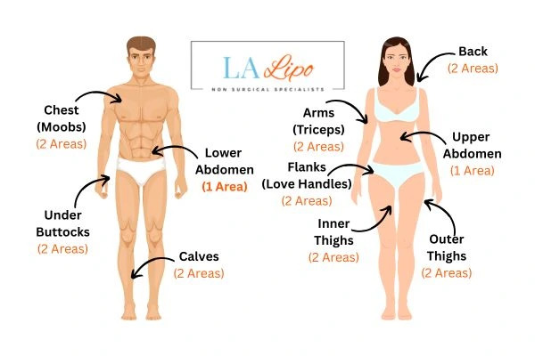 LA LIPO Cryolipolysis Areas Edmonton