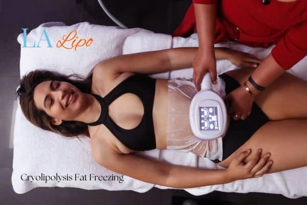 woman getting cryolipolysis Edmonton