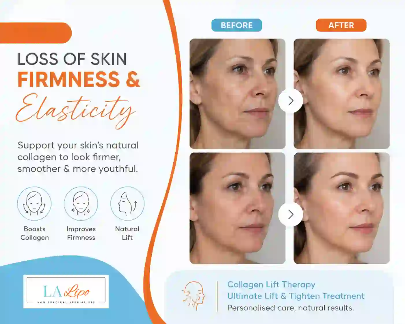Sign #7: Loss of Skin Firmness and Elasticity Edmonton
